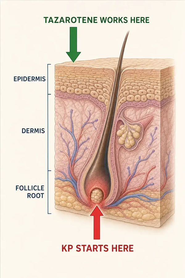 Urea reaches inside the follicle. This is what most products skip.
