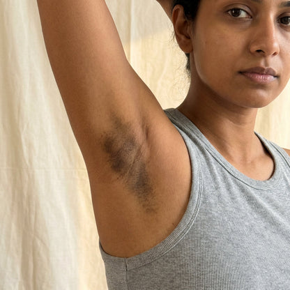 Week 1-2 same arm, heavy PIH
